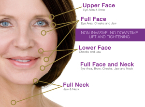 ultherapy_diagram11